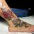 00006 ink4skin