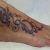 00020 ink4skin