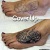 00083 ink4skin