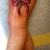 00100 ink4skin