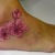00133 ink4skin