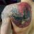 00229 - ink4skin