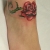 00241 - ink4skin