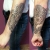 00256 - ink4skin