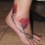 00279 - ink4skin