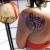 00281 - ink4skin