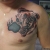 00285 -ink4skin