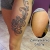 00287 - ink4skin