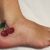 00288 - ink4skin